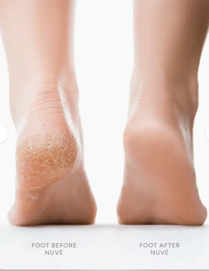 Rapeuse pieds électrique